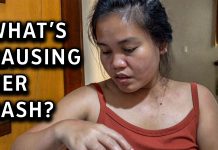 Fatima Has Allergic Reaction To Hairy Caterpillar! Fatima Has Allergic Reaction To Hairy Caterpillar!